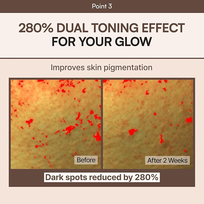 Milky Lotion | Soymilk Relief Protein Lotion | Skin Barrier Support, Hydration, Glow, Brightening | OAT and SOYBEAN EXTRACT, Niacinamide | Dry, Flaky Skin | Korean Skincare | 5.07 fl.oz.