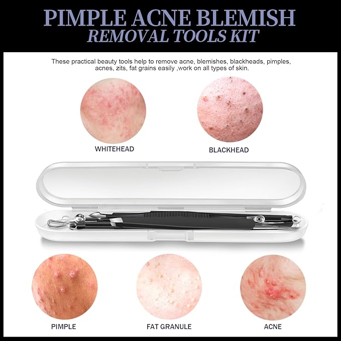 Teenitor Blackhead Remover Tools, Pimple Popper Tool Kit, Ingrown Hair Tweezers, Precision Tweezers, Surgical Grade Blackhead Extractor Pimple Extractor, Black