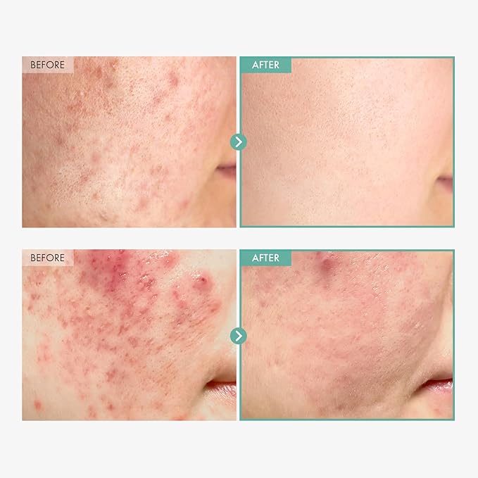 Dexpanthenol Cream, 170,000ppm B5 Panthenol, Madecassoside, Centella Asiatica for Skin Barrier Repair, Facial Moisturizer, Soothing, Hydrating, Korean Skincare, 60ml, 2.02 fl. oz.