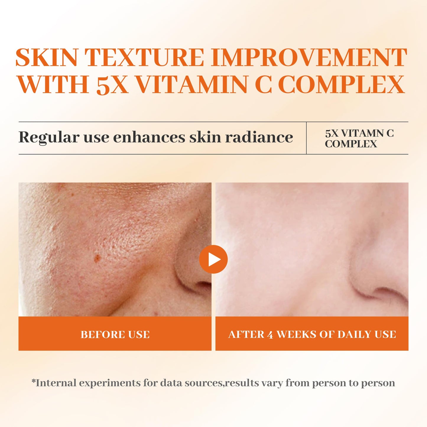 5X Vitamin C Toner HONLINK Facial Care Toner, Hyaluronic Acid Hydrating Facial Treatment for Even Skin Korean Tone, Safe Glowing Skin 130ml,K-Beauty,Tk Popular Skin Care Products, Women Gift