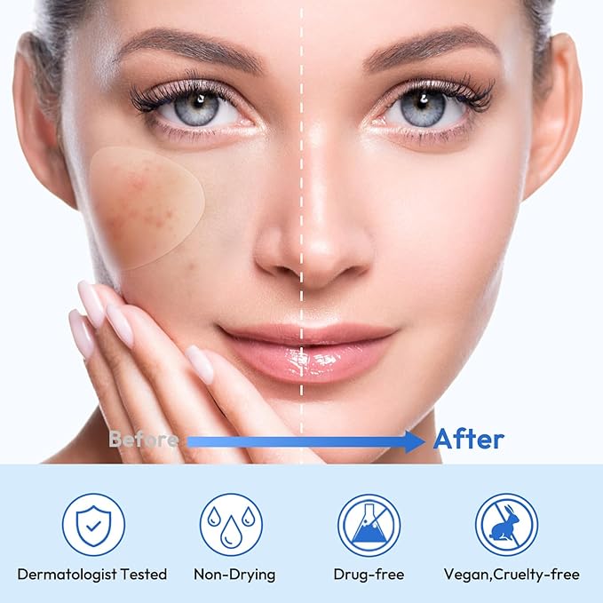 Full Face Pimple Patches(5 Pack),Big Hydrocolloid Acne Patches,Skin Care Zit Patches for Whole Face,Nose, Chin, Forehead & Cheeks w/Tea Tree Oil, Salicylic Acid & Cica Oil（5 Pack,25 Patches）