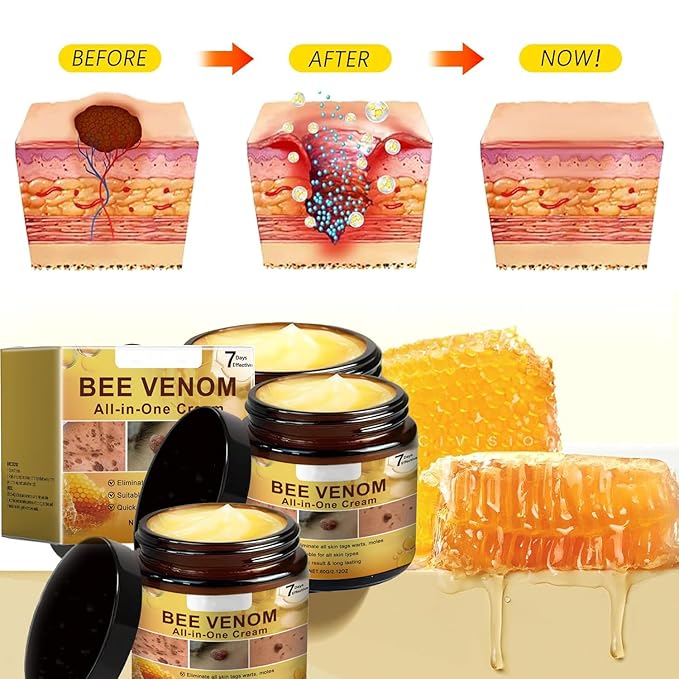 Gaukomzs 2-Pack Bee Venom Cream, New Professional Bee Venom Repair Cream, Natural Skin Moisturizer For All Skin Types