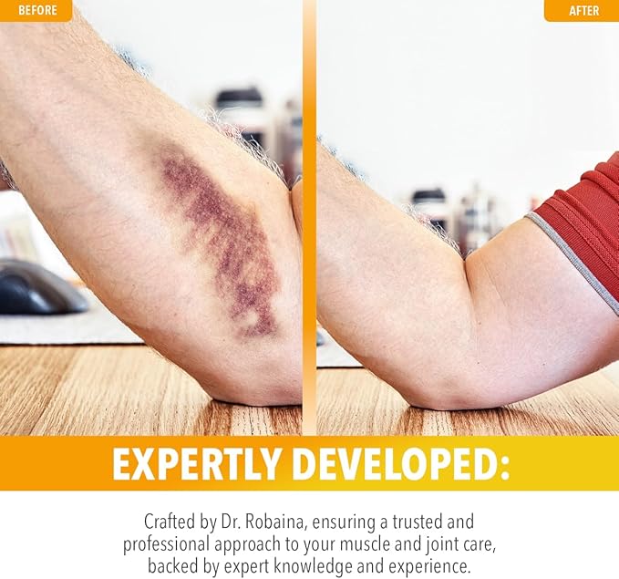 Dr. Robaina Arnica Bruise Cream 4 oz – Concentrated Arnica & Vitamin K Moisturizer for Skin That Looks More Even After Bumps & Cosmetic Touch-Ups – Fast-Absorbing, Non-Greasy, Made in USA