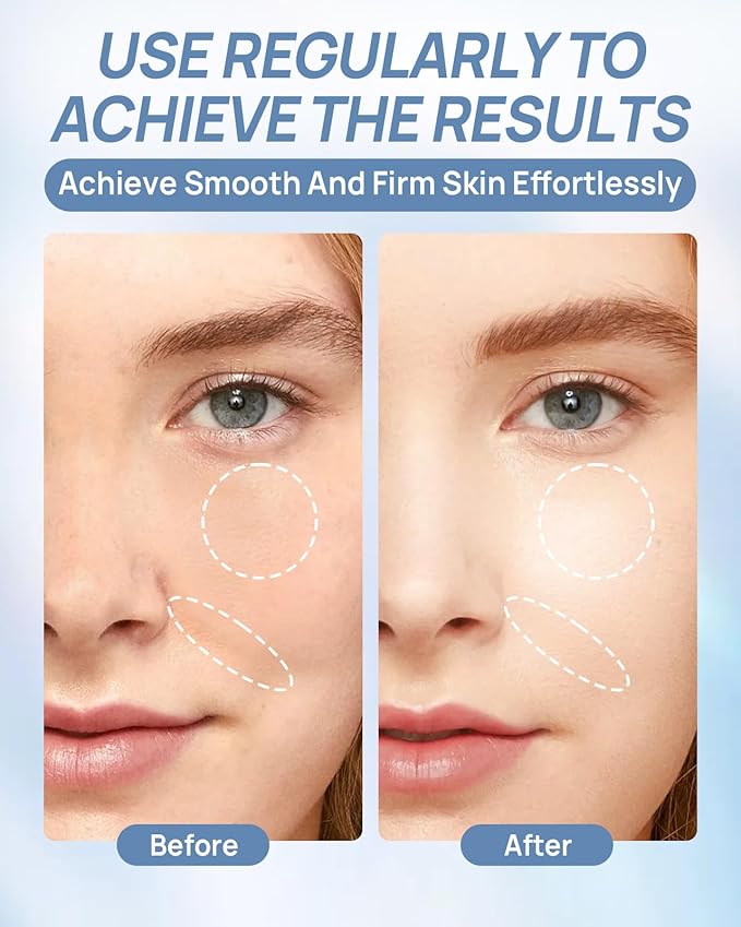 6 Pcs Bio-Collagen Overnight Face Mask, Hydrating Hydrogel Face Masks for All Skin Types - Fine Lines, Elasticity, Pore Minimizing, Firming, Glass Skin Korean Skincare