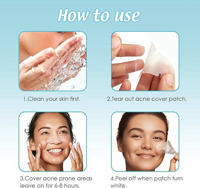 Pimple Patches for Nose 10 CT Acne Patches Nose Pore Strips XL Hydrocolloid Bandages for Face Blemish Pimple Patch Absorbs Oil Overnight