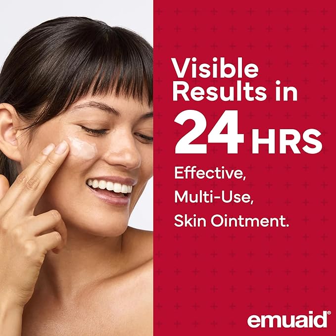 emuaid EMUAIDMAX Eczema Ointment, Maximum Strength Soothing Relief for Eczema, Psoriasis, Athlete’s Foot, Jock Itch, Rashes, Itchy, Dry, Irritated Skin and Minor Skin Irritations, 16oz