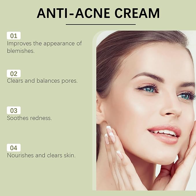 Acne Cream for Face – 15g Oil Balancing Pimple, Helps Reduce Breakouts for Oily & Blemish-Prone Skin, Gentle Daily Moisturizer for Teens & Adults (Unisex, Cruelty-Free)