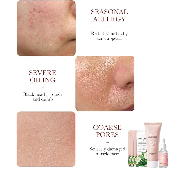 Camellia Extract Skin Care Sets, Skin