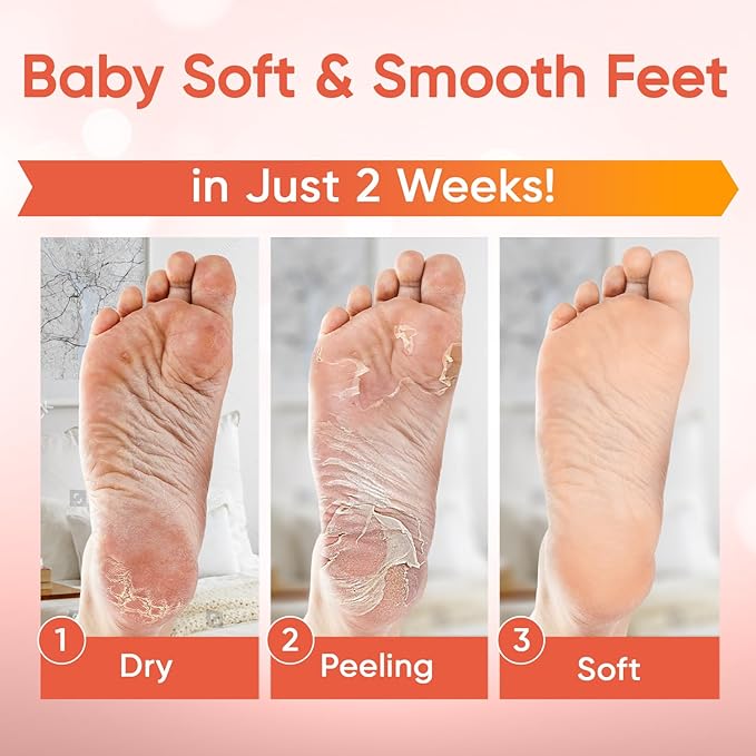 Foot Peel Mask - Foot Mask for Baby Soft Skin - Remove Dead Skin, Dry, Cracked Feet & Callus, Foot Spa, Made with Aloe Vera Extract for Women and Men (2 Pairs Peach)