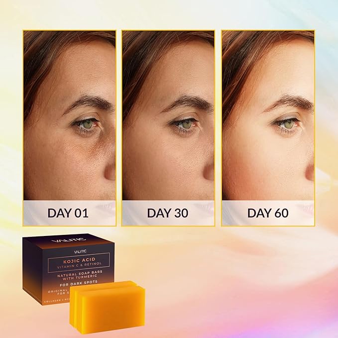 VALITIC Kojic Acid Vitamin C and Retinol Soap Bars with Turmeric for Dark Spot - Original Japanese Complex with Collagen, Hyaluronic Acid, Vitamin E (2-Pack) - with Soap Holder