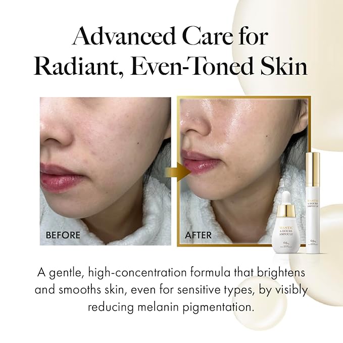 MASTINA Mastic Serum Roller - Dark Circle Remover & Eye Serum for Brighter, Firmer Under Eyes, Korean Skin Care, 0.5 fl oz,White Mastic Complex 63% + Tranexamic Acid 2% + Niacinamide 5%