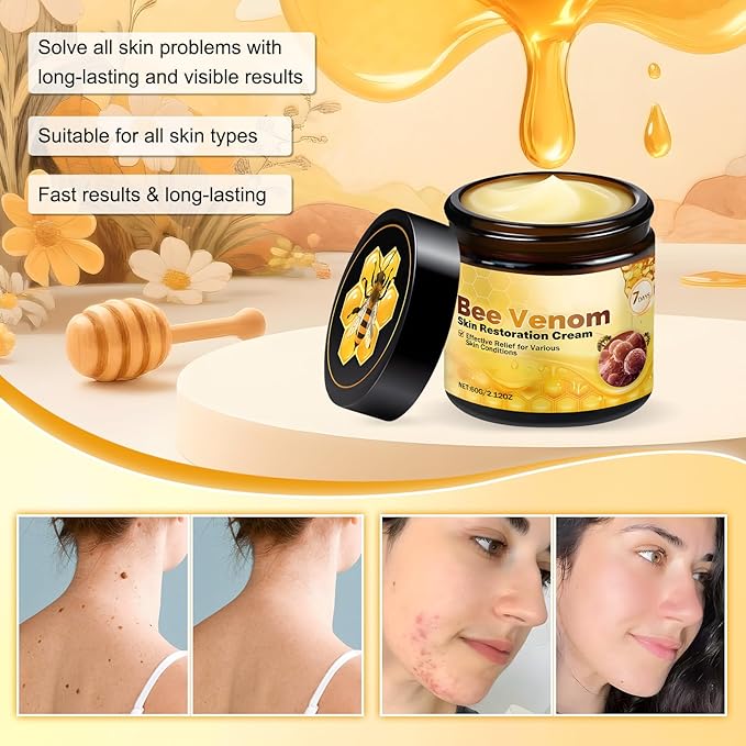 Bee Venom Skin Restoration Cream, Professional Repair & Wrinkle Care Formula & Repair Reduces Blemishes for All Skin Type (2PCS)