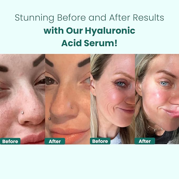 Gin Amber Beauty - Pack of 4 Serums (1 fl oz - 30 ml)