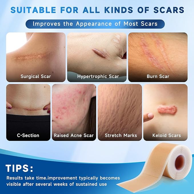 Silicone Scar Sheets, Silicone Scar Tape(1.6” x 60” Roll 1.5M), Silicone Scar Sheets for Surgical Scars, Keloid Bump Removal, Stretch Marks Removal, C-Section, Burn et