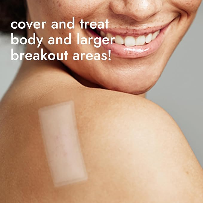 Epielle Over-Zit XL Acne Clear Patches | Ultimate Hydrocolloid Solution | 14 Extra-Large Pimple and Blemish Patches