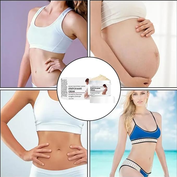 Stretch Mark Prevention Cream for Pregnancy,