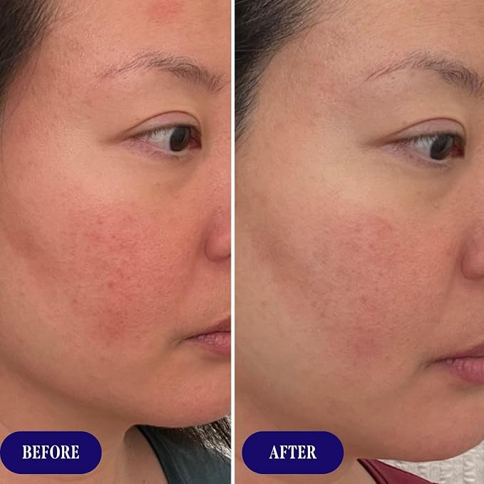 Three Ships Replenish Barrier Repair Serum with Ceramides + Blueberry Oil - Soothing Face Serum, Supports Skin Barrier and Reduces Redness (1 floz)