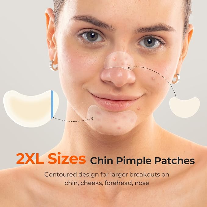 TKTK Chin Pimple Patches (100 Count 6 Sizes), XL Contoured Hydrocolloid Chin Patch 62x42 mm, Large Acne Patch for Face Blemishes Zit Breakouts, Maximum Absorption Overnight Stickers