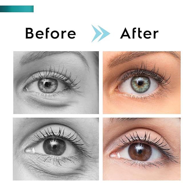 Under Eye Cream for Dark Circles and Puffiness, Eye Serum with Caffeine, Retinol, Peptides & Hyaluronic Acid.