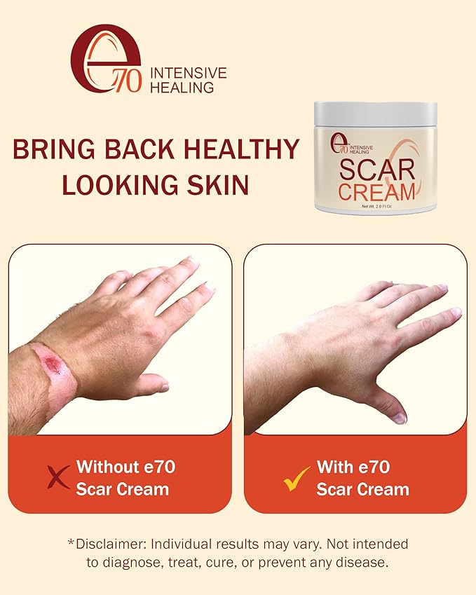 Scar Cream Gel for Surgical Scars Fast Repair C-Section -2.0 Fl Oz , Stretch Marks, Keloids, Burns, Scar Away Cream for Old Scars. Vitamins Full - All Skin Types - Reduce Acne Spots and scar treatment