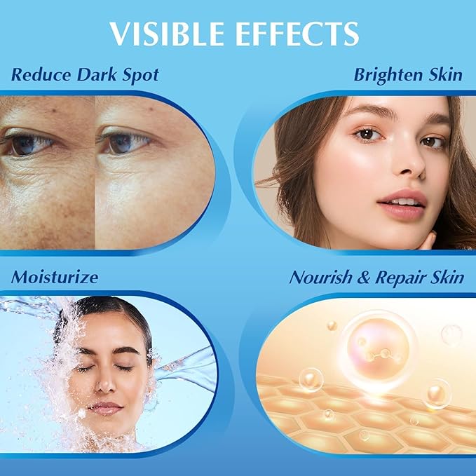 EnaSkin Dark Spot Remover for Face: Hyperpigmentation Body Treatment for Freckles Melasma Age Spot Sun Spot - Dark Spots Corrector Serum for Women and Men (1.0 Fl Oz)