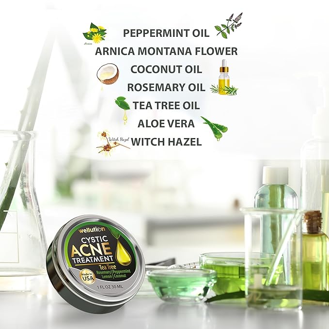 Cystic Acne Spot Treatment – Tea Tree Acne Cream – Fast-Acting Acne Spot Corrector for Face, Pimples & Blemishes – Non-Greasy, Gentle Formula – 1oz – by WELLUTION