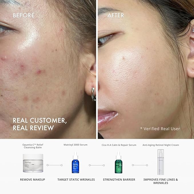 Depology CICA H.A Calm & Repair Serum | Reducing Discomfortable and Sensitivity Face Serum | Hydrating & Replenishing Facial Skin Care Product | Providing Relief from Redness Serum 1.01 fl.Oz