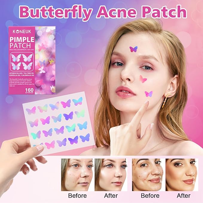 Acne Pimple Patches for Face (160 Counts), Hydrocolloid Acne Patches with Tea Tree Oil and Calendula Extract, Cute Colorful Butterfly Shape Spot Stickers for Skin Care, Zit Patches