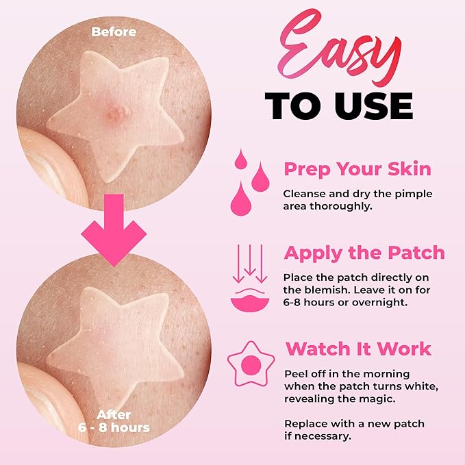 260Pcs Cute Pimple Patches for Face - Hydrocolloid Acne and Zit Patches - Blemish Stickers for Face Skin Care - Star, Heart, Cloud, Moon, Glitter & Regular Shapes, 7 Colors, 2 Sizes Stickers