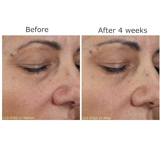 Daily Moisturizing Collection, Activator with Brightening