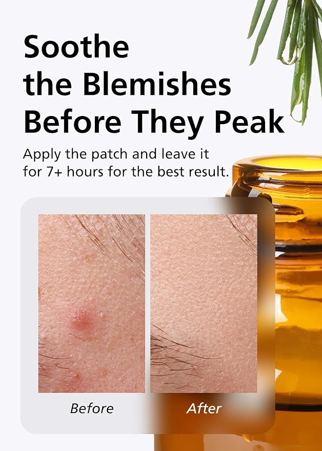 Easyderm Bear& Bunny Pimple Patches - 7,000 PPM Tea Tree Oil(126 Counts), Salicylic Acid, Free Hairband Included - Holiday Gift, Easter Day Gift, Stocking Stuffer for Teens & Women