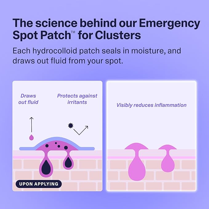 Curology Emergency Spot Patch Clusters for Breakouts, Fast Acting Large Hydrocolloid Pimple Patches for Face, Oil Absorbing, 14 Count