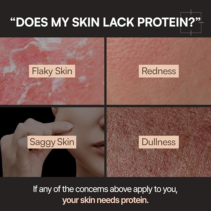 Milky Lotion | Soymilk Relief Protein Lotion | Skin Barrier Support, Hydration, Glow, Brightening | OAT and SOYBEAN EXTRACT, Niacinamide | Dry, Flaky Skin | Korean Skincare | 5.07 fl.oz.