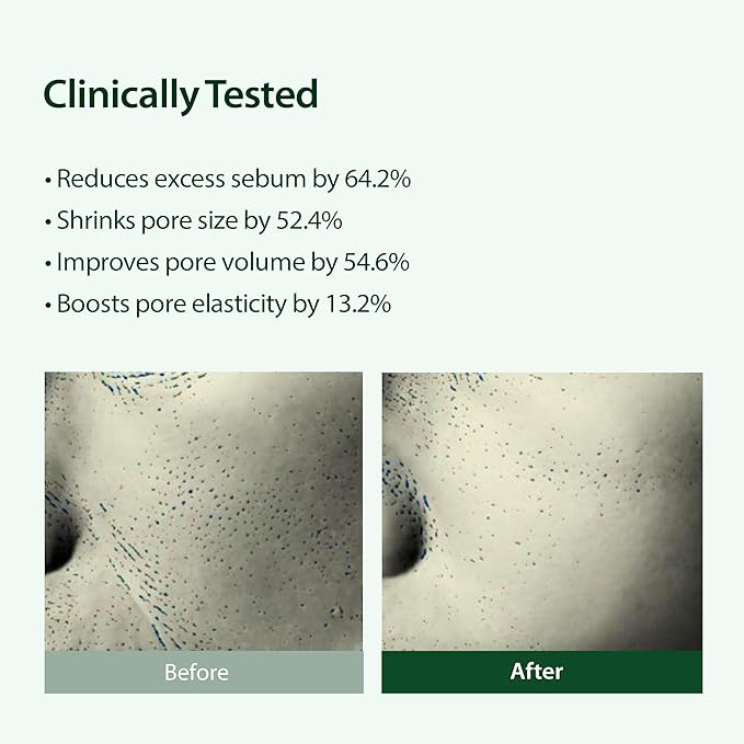 BLITHE Targeted Pore Serum with 22% Niacinamide for Oil Control, Pore Minimizer for Face, Korean Skin Care – 1 fl oz