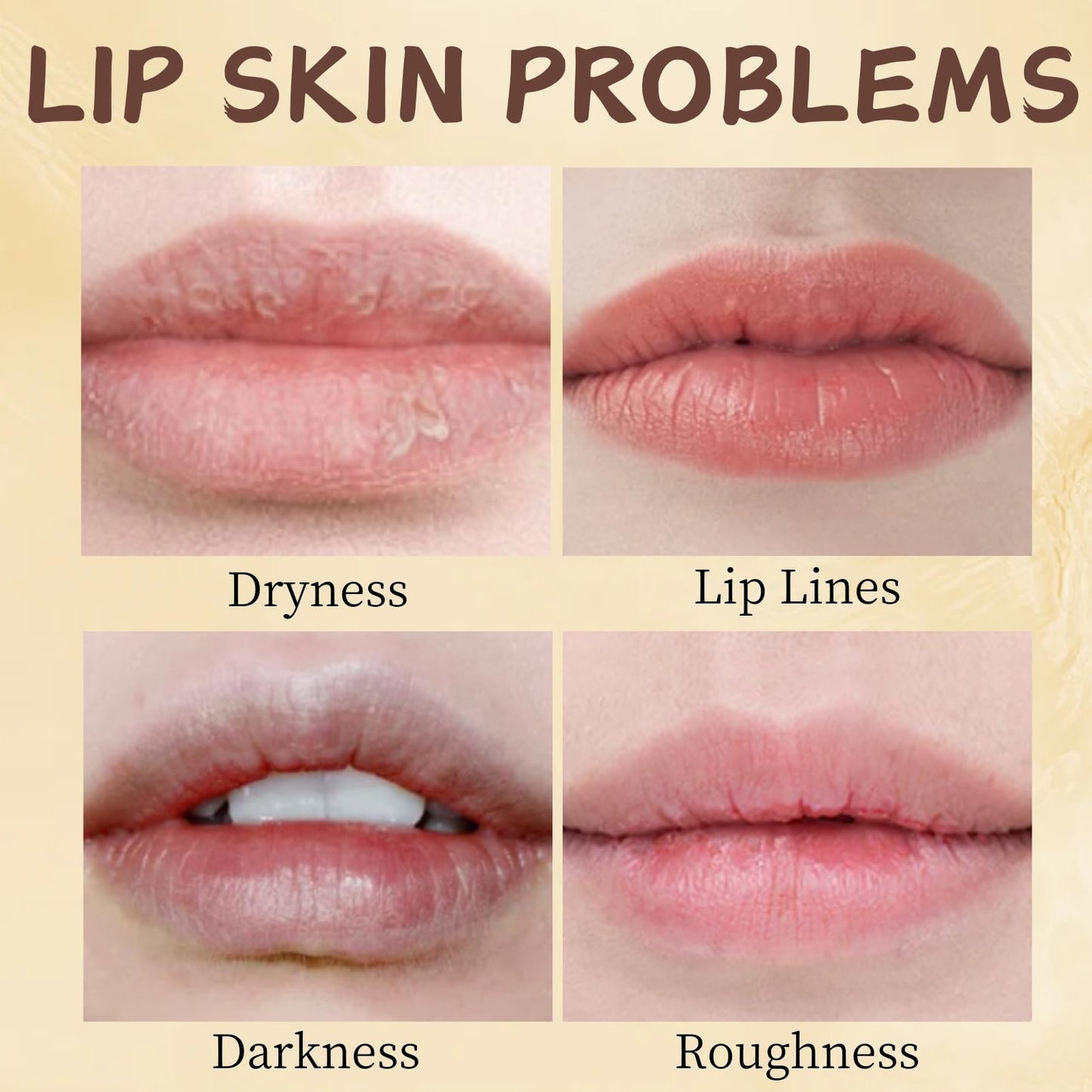 5PCS Bee Lip Balm Honey Pot - Lip Sleeping Mask - Moisturizing Lip Gloss for Women - Lip Mask Overnight Gift Set - Tinted Lip Balm - lip balm Hydrating - Honey,Cherry,Strawberry,Apple Lime,Watermelon