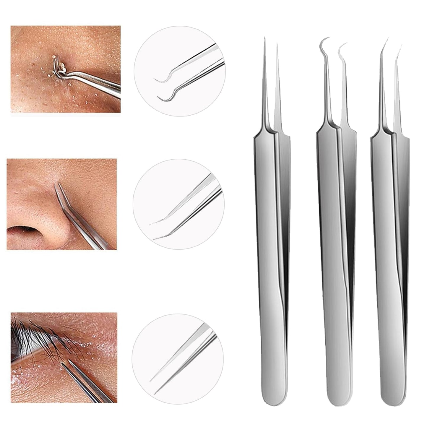 WSYUB Blackhead Tweezers, Blackhead Extractor, Pimple Popper Tool Kit, 3 in 1 Professional Stainless Skin Zit Acne Blemish Whitehead Popping Removing Surgical Tools Set, Silver