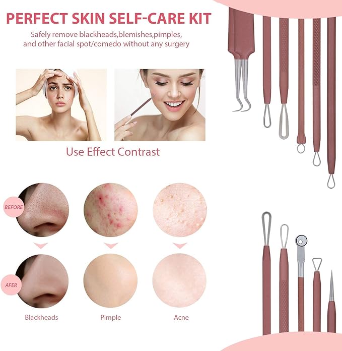 JPNK Blackhead Remover Tool Comedones Extractor Acne Removal Kit for Blemish, Whitehead Popping, 6 Pcs Zit Removing for Nose Face Tools with a Leather Bag (Pink)