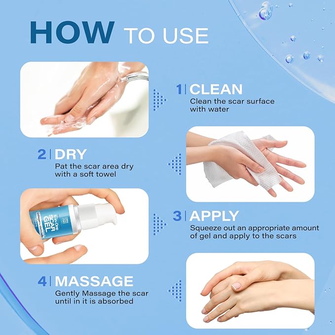 5-in-1 Scar Cream for Surgical Scars: Advance Silicone Scar Gel with Collagen and Stem Cells, Keloid Scar Treatment, Scars Removal of New and Old Scars, Piercing, Burns, C-section, After Surgery, 50g