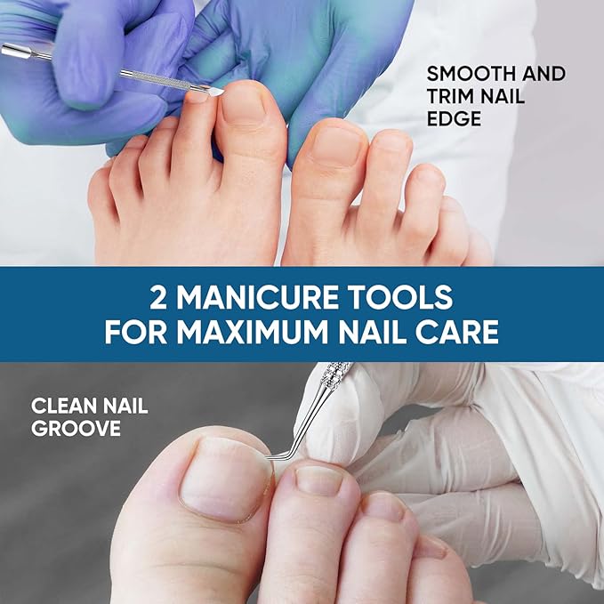 Ingrown Toenail Treatment, 60Pcs Ingrown Toenail