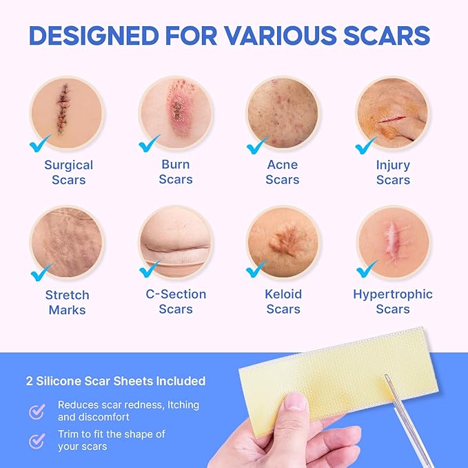 Advanced Silicone Scar Removal Cream - Medical Grade Surgical Scars Gel for Face & Body - New & Old Scars Treatment for Acne, Burns & Surgery, Kids Over 6 Months, 1 oz