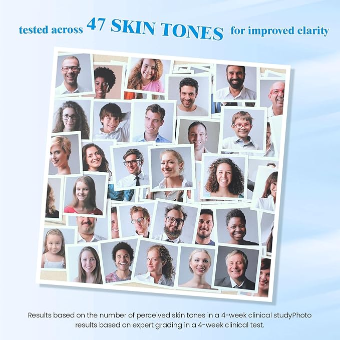 Dark Spot Remover for Face,Dark Spot Corrector, Dark Spot Serum for Sun Spots, Age Spots, Brown Spots,Acne Scars,Melasma Brown Spot -Advanced Formula with Niacinamide Retinol for Women (1.0 Fl Oz)