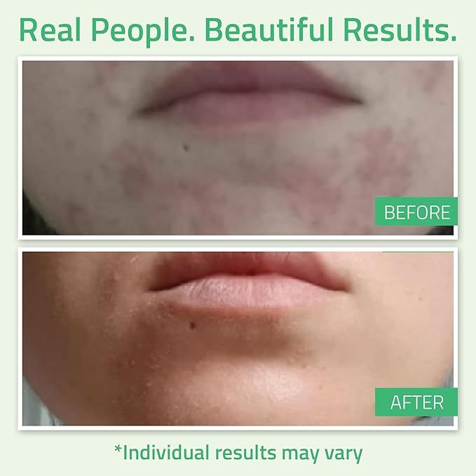 YEOUTH Glycolic Acid Peel for Face, At Home Exfoliator Aha 30% Glycolic Acid Face Peel with Retinol, Designed to Refresh & Smooth the Appearance of Skin 1oz