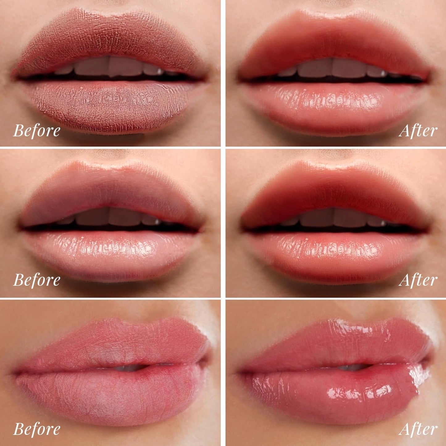 ANRCOLLECT Lip Scrub & Lip Mask - Overnight Treatment Lip Care Kits with 2 Lip Exfoliator & 2 Sleeping Lip Balm, Intense Hydration Lip Set for Dry Chapped Cracked Lips, Exfoliate & Moisturize (4 Pack)