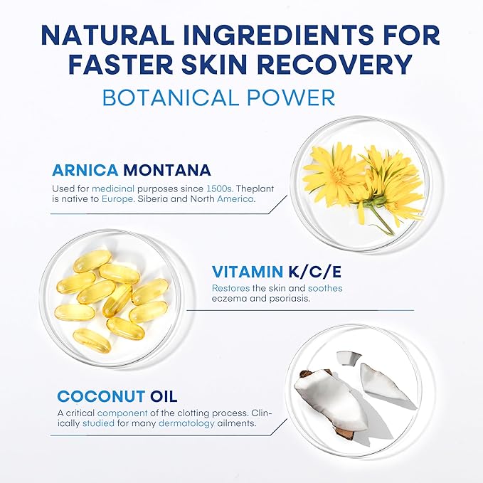 Hermon Arnica Bruise Cream Extra Strength: Fast-Acting for Bruising & Swelling on Thin Skin - High Strength Arnica Montana with Vitamins K, C & E–Hydrating Moisturizer for Face (4 oz(pack of 1))