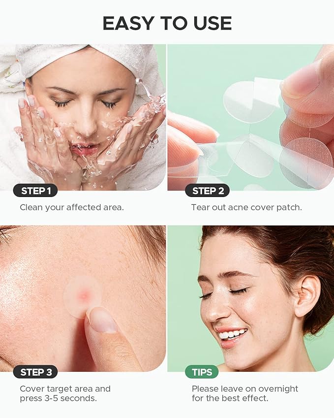Acne Pimple Patch (180 Counts 4 Sizes), FSA Eligible Invisible Hydrocolloid Acne Patch with Tea Tree Oil & Calendula Oil, Acne Spot Patch Zit Patches for Face