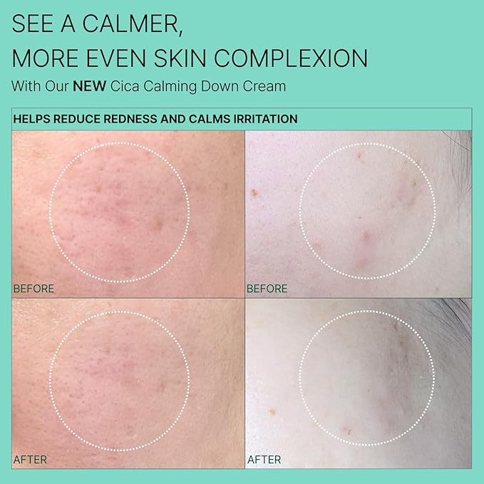 Cell Fusion C Calming Down Cream, CICA, Redness Relieving Moisturizer for Sensitive Skin, Green Color Correcting, Centella Asiatica, 50ml / 1.69 fl.oz