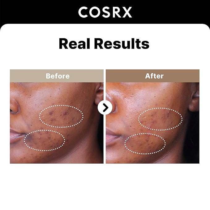 COSRX 2% Alpha Arbutin Discoloration Care Face Serum with Niacinamide, Glutathione & Tranexamic Acid, 1.7 fl oz – Serum for Face, Korean Skin Care