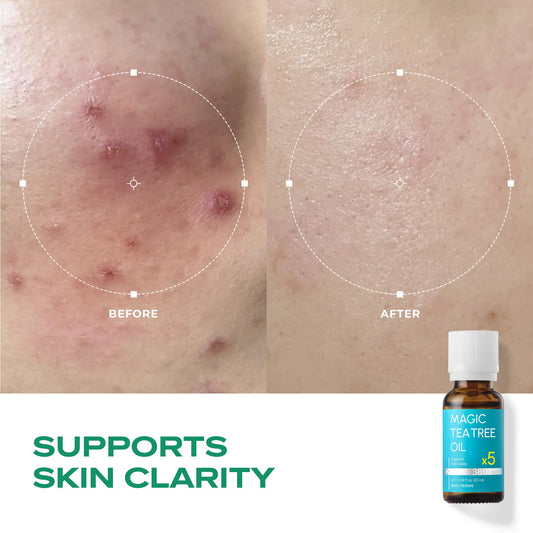 BLANC NATURE – Magic Tea Tree Oil for Face, Clarifying Facial Oil for Oily & Sensitive Skin, Lightweight Daily Care with Tea Tree, Skin-Balancing Vegan Korean Skincare, 0.7 fl oz