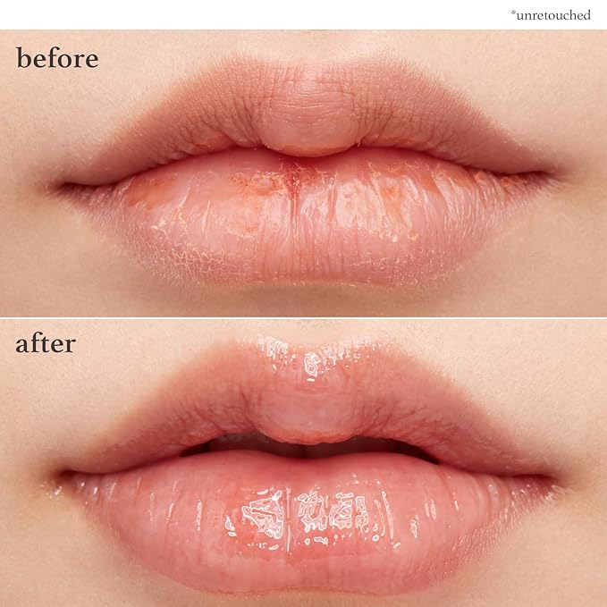 NOONI Vegan Applebutter Lip Mask Overnight – Hydrating Lip Balm & Butter with Shea Butter & Vitamins | Soothing Moisturizer, Softening Treatment for Dry Lips, 0.42 oz