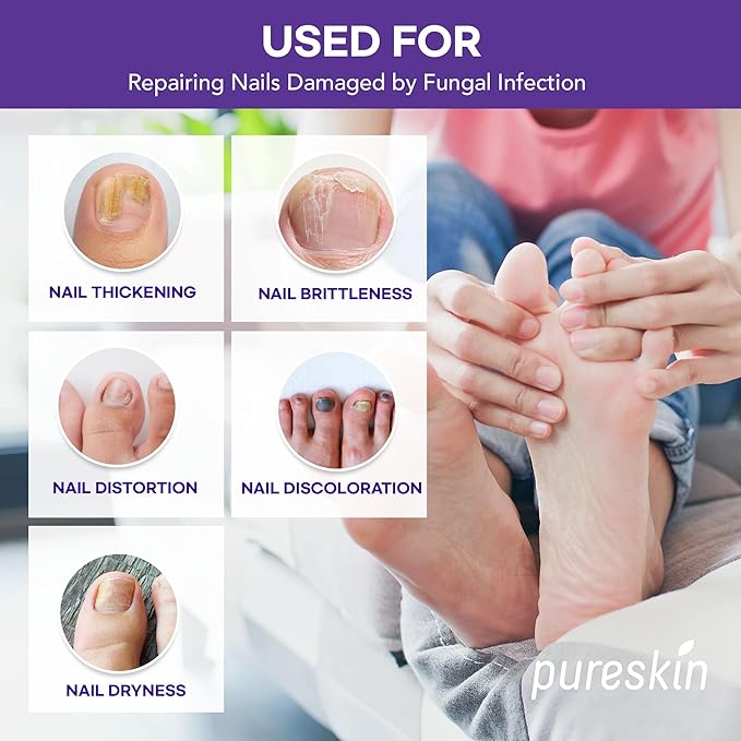 Extra Strength Toenail Fungus Treatment